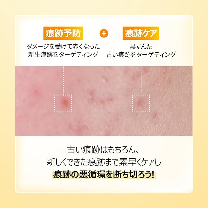 5番 白玉グルタチオンCメラゼロクリーム – &choa!